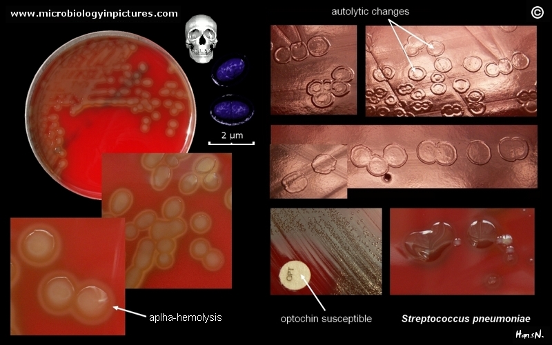 Streptococcus pneumoniae picture